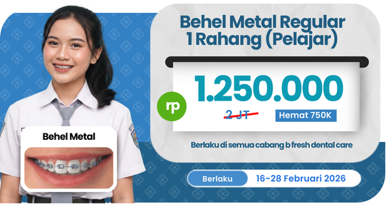 Behel Metal Regular (Pelajar)